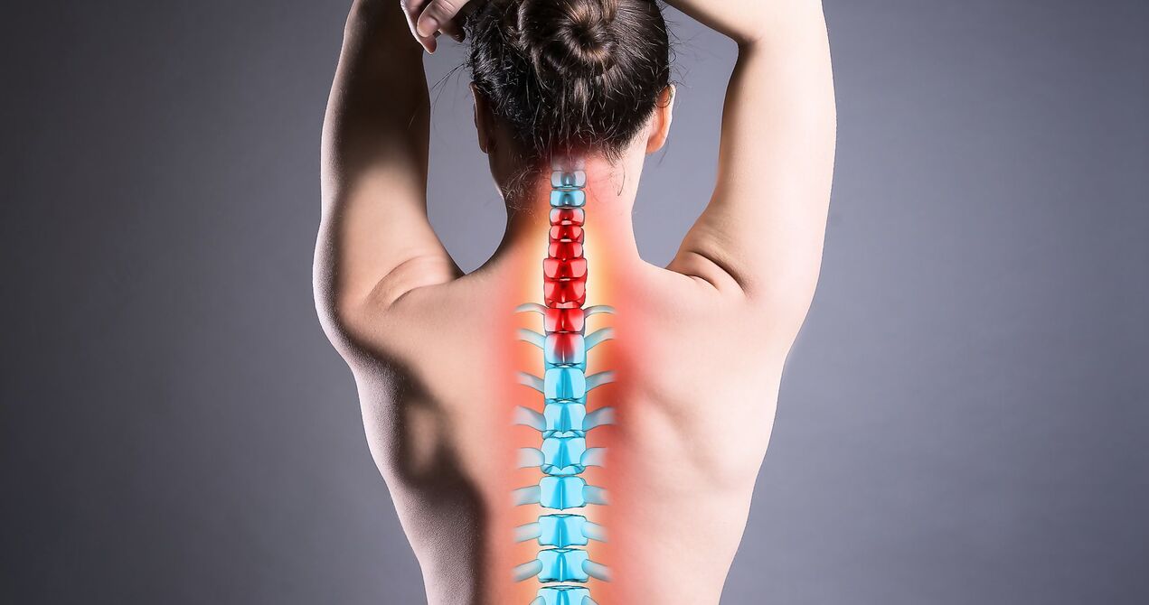 Aarte vu Spinal Osteochondrose